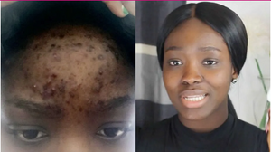 100% Natural Vitamin C Serum